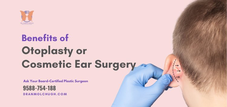 What is Otoplasty and Why is it Beneficial?