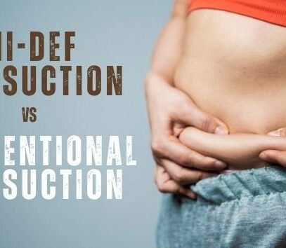 How does Hi-def liposuction compare to conventional liposuction on the body areas being treated?