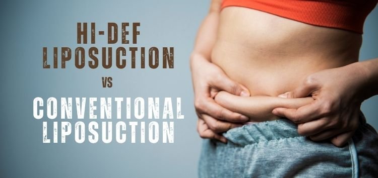 How does Hi-def liposuction compare to conventional liposuction on the body areas being treated?