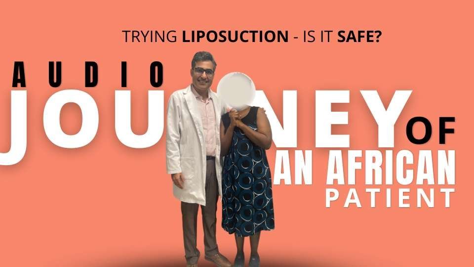 Trying Liposuction - Is It Safe