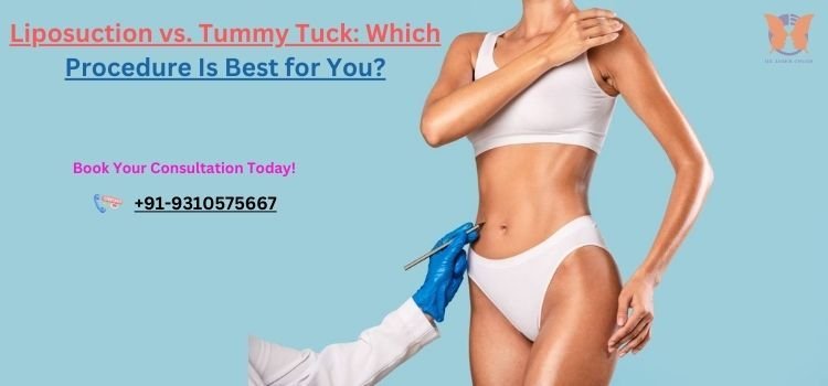 Liposuction vs. Tummy Tuck Which Procedure Is Best for You