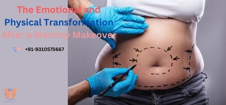 The Emotional and Physical Transformation After a Mommy Makeover
