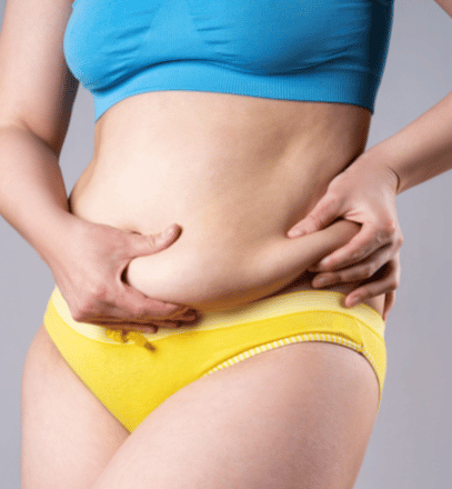 Understanding surgical options for apron belly and tummy tuck procedures