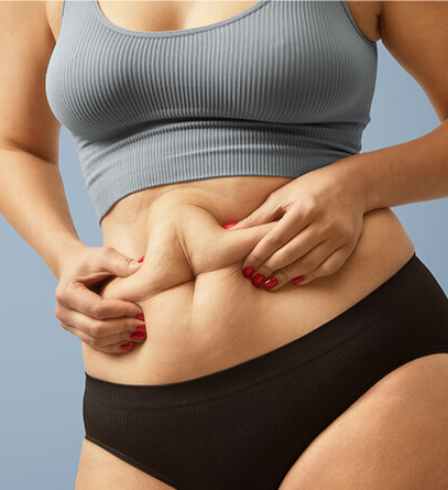 Understanding the cost and planning for tummy tuck surgery