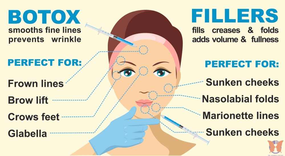 Botox vs. fillers – Understanding the difference and choosing the right treatment