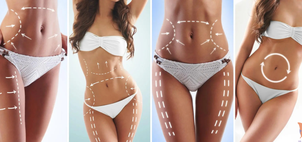 Illustration of how liposuction works to remove excess fat from the body